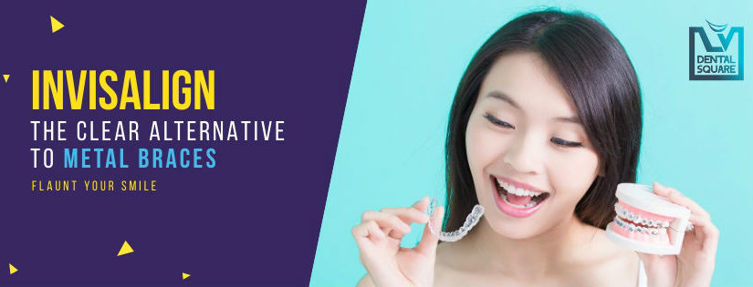 Invisalign alternative to metal braces