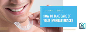 how to take care of you invisible braces