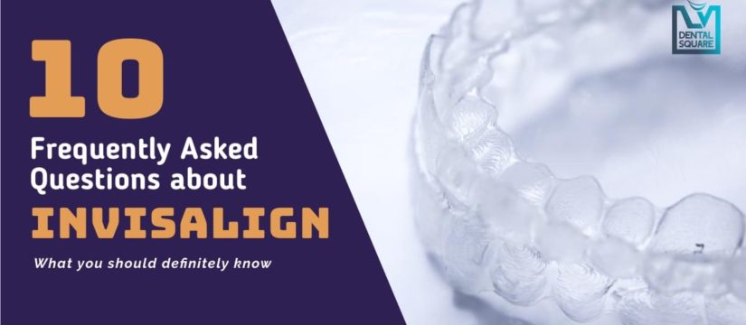 10 faqs about invisalign braces