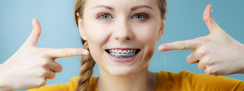 Ceramic Braces at best price in Bengaluru