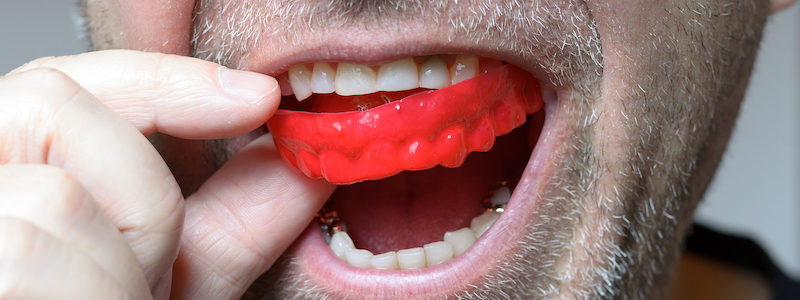 How It's Made  Custom Fit Mouthguards - Mouthpiece Guy