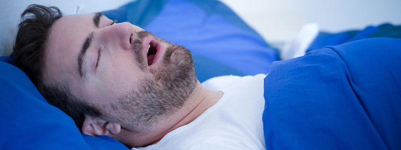 sleep apnea treatment