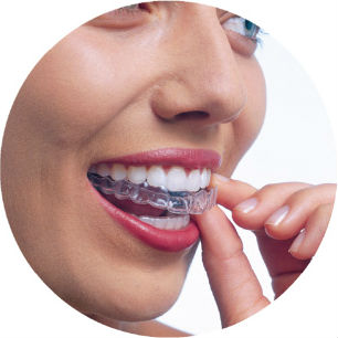 Invisalign open day 2