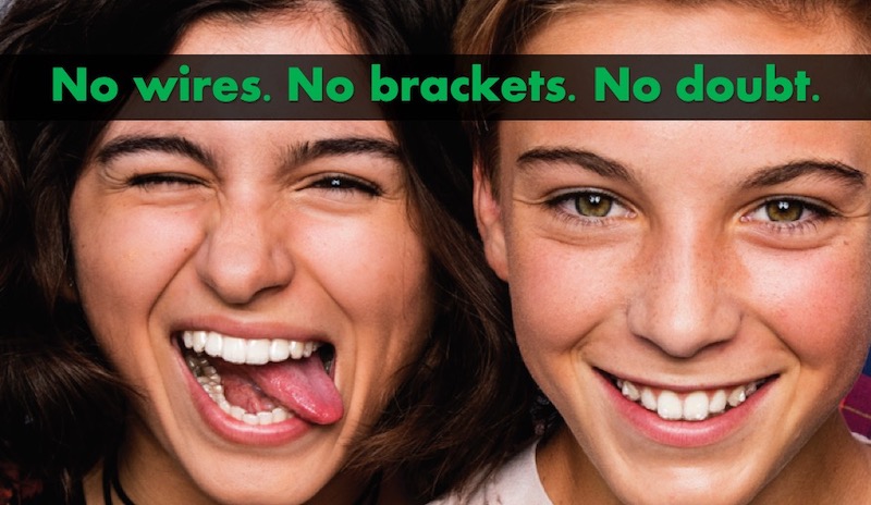 teen invisalign braces in bangalore