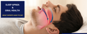 Sleep Apnea and Oral health What experts have to say