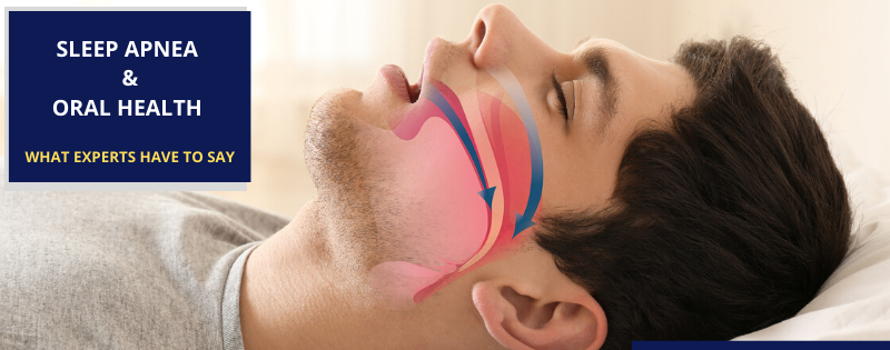 Sleep Apnea and Oral health What experts have to say